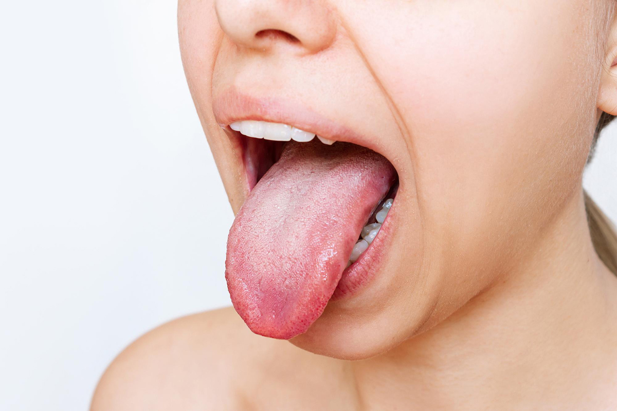 Why Your Tongue Is Important To Your Overall Health
